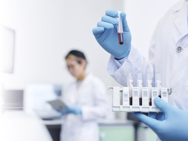 Laborvizsgálati szűrőcsomagok a Tagore Medical Centerben
